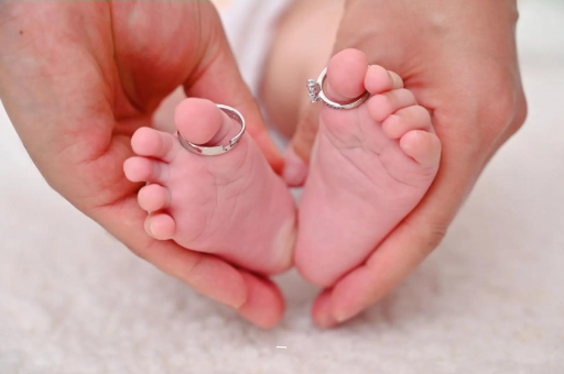 东海孕妇怎样预防妊娠纹 东海孕妇怎样预防妊娠纹